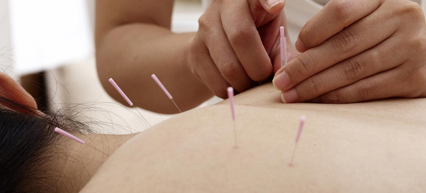 Acupuncture Therapy By Global Pain And Spine Clinic, Kanpur - Dr. Rajneesh Tripathi