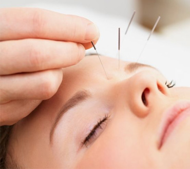 Acupuncture Therapy in Kanpur, Global Pain And Spine Clinic, Dr. Rajneesh Tripathi